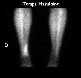 Temps tissulaire