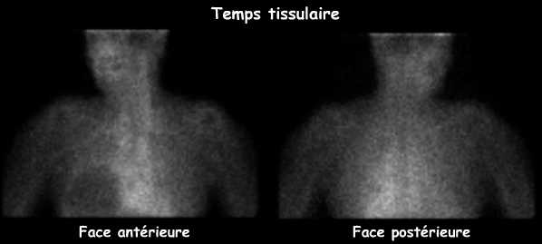 Temps tissulaire