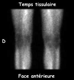 Temps tissulaire